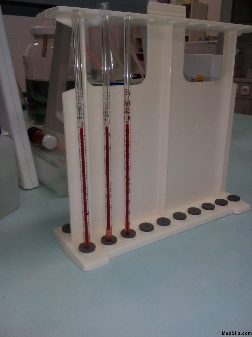 Капилляры, расположенные в штативе, для определения СОЭ по методу Панченкова.